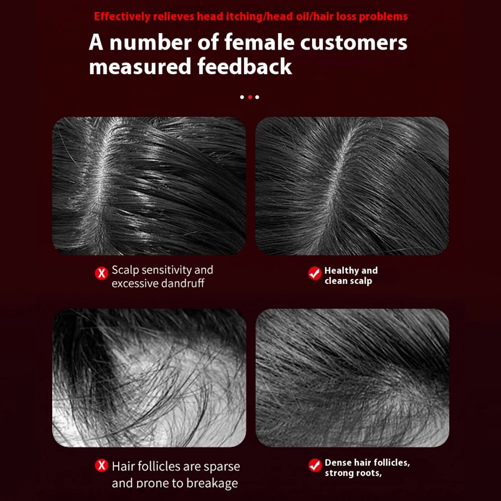 Lumea Scalp Massage